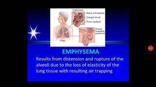 Emphysema and empyema [upl. by Harilda]