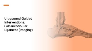 Ankle CFL Imaging [upl. by Chong315]