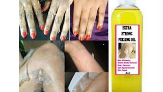 Extra strong peeling oil [upl. by Siloam761]