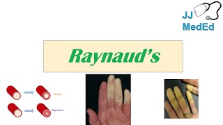 Introduction to Raynaud’s Phenomenon Syndrome  Pathophysiology Triggers Symptoms Treatment [upl. by Alden]