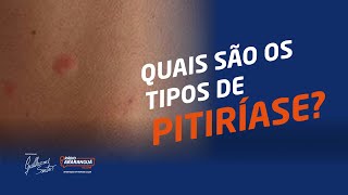 Quais são os TIPOS de PITIRÍASE  Dicas de Saúde [upl. by Stubbs]