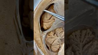 Incredible Tissue Surrounding Your Brain  Institute of Human Anatomy [upl. by Kobi56]