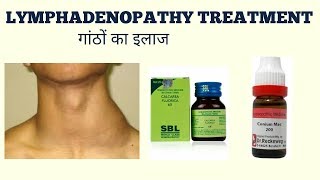 LYMPHADENOPATHY TREATMENTगांठों का ईलाज [upl. by Iramo846]