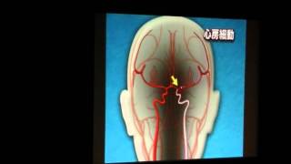 【医療情報セミナー】循環器疾患が怖い！～今すぐ治そう！～ [upl. by Freytag926]