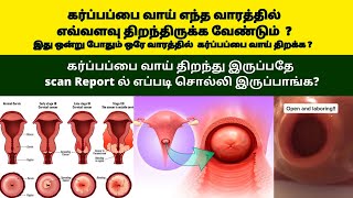 cervix dilation during pregnancy in tamil  Cervix dilation during pregnancy third trimester [upl. by Hannover]