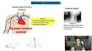 Contextualizando as Veias Profundas  Acesso Venoso Profundo [upl. by Vasilis]