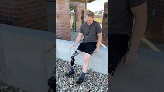 Luke’s Life as an Amputee Allux 2 Knee Transformed His Everyday prosthetics limblab nebraska [upl. by Vilberg]