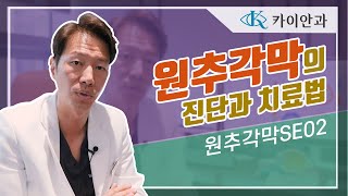 원추각막의 진단과 치료법은  원추각막의 진단 치료  시력교정  각막이상  안과질환  카이안과TV [upl. by Bernita]