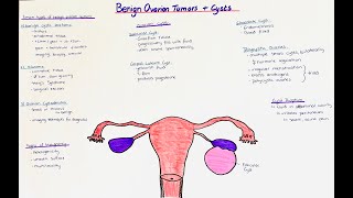 Benign Ovarian Tumors  Ovarian Cysts  histology  clinics [upl. by Aiekahs]