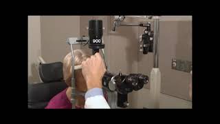 Ophthalmology basic exam slit lamp exam [upl. by Geis279]