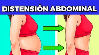 Como reducir la distension abdominal rapidamente [upl. by Iclek]