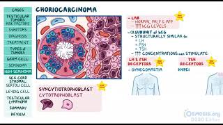 Testicular Tumors  Osmosis [upl. by Aneleiram906]