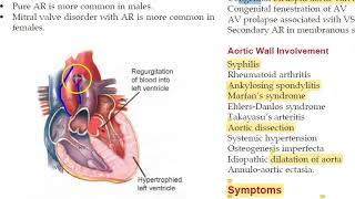 Medicine 156 Aortic Regurgitation Austin Flint Early Diastolic Murmur Water Hammer Pulse collapsing [upl. by Southard238]