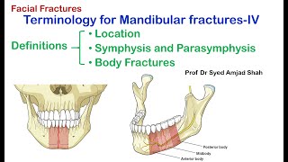 Definition Symphysis  Parasymphysis  Body  Mandibular Fractures  Syed Amjad Shah [upl. by Rois]