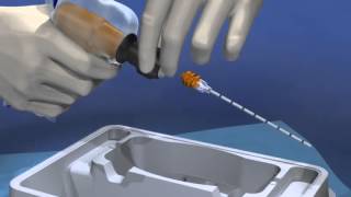 Arrow® OnControl® Bone Marrow Aspiration amp Biopsy Procedure  MC 001172 [upl. by Alphard990]