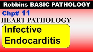 Chp11 Robbins Patho  Heart Pathology  Infective Endocarditis  Dr Asif Lectures [upl. by Noleta575]