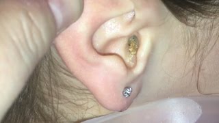 Ear Wax Build UP Ranting MOM [upl. by Yleve]