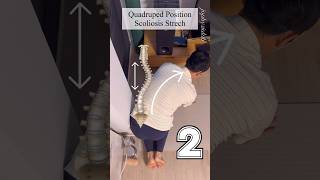 Scoliosis Exercise  Three Simple Scoliosis Streches [upl. by Ybanrab305]