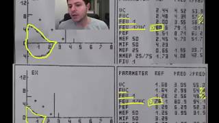 Spirometrie 5  exemple DVR disfunctie ventilatorie restrictiva [upl. by Sekyere]