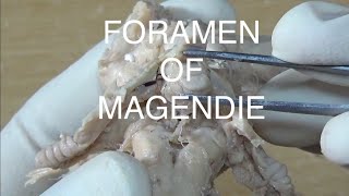 FORAMEN OF MAGENDIE [upl. by Vally]