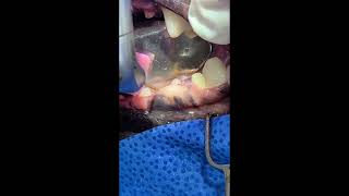 Gingivectomy Gingival enlargement of a dog Removed by laser 치은 절제술 [upl. by Neelon]