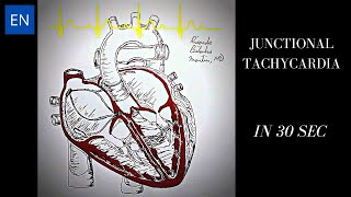 Junctional Tachycardia Animation and ECG Shorts [upl. by Fisch805]