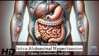 IntraAbdominal Hypertension Demystified Causes Effects and Solutions [upl. by Harriet979]