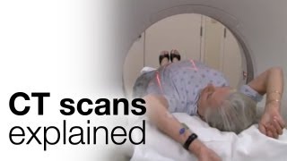 How to prepare for a CT scan [upl. by Previdi360]