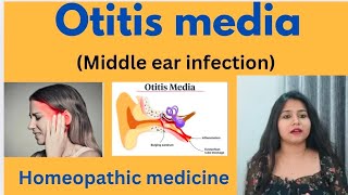 Otitis media middle ear infection treatment  Ear infection symptomscause amp homeopathic medicine [upl. by Ynohtnanhoj386]