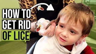 Head Lice Combing Techniques  How to Check for Lice at Home [upl. by Marie-Jeanne]