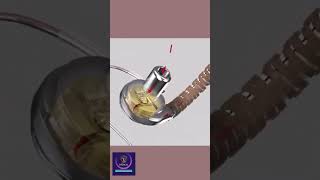 Heartware Ventricular Assist Device shorts animation [upl. by Ahsla]