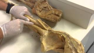 Anatomy Lab  10  Muscle of Lower Limb Part 01 [upl. by Nivej217]