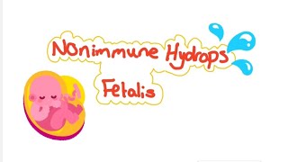 Nonimmune hydrops fetalis [upl. by Haniraz]