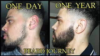 ONE YEAR TRANSFORMATION My Minoxidil Beard Journey  Whats To Come in 2020 [upl. by Harli]