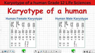 Karyotype of a human Grade 12 Life Sciences [upl. by Phylis]