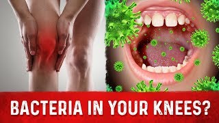 Knee Arthritis amp Your Mouth Bacteria – Arthritis Knee Pain Relief – DrBerg [upl. by Sivar843]