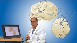 Plagiocephaly and its treatment  Boston Children’s Hospital [upl. by Nwahsud]