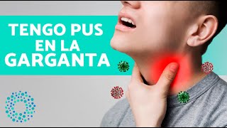 ¿Por Qué Sale PUS en la GARGANTA ⚪ Infección en Garganta con Pus [upl. by Haidej]