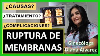 RUPTURA DE MEMBRANAS POR GINECOLOGA DIANA ALVAREZ [upl. by Htebasil]