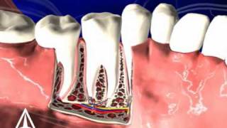 Tooth Anatomy  3D Medical Animation [upl. by Prudie]