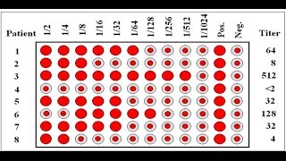 Introduction to Agglutination  التراص أو التلازن [upl. by Nordna]