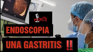 Está dañado el revestimiento de su estómago Gastropatía severa detectada con endoscopia [upl. by Macrae]