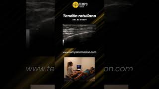 Tendon rotuliano y ecografia con Ana de Groot ecografia fisioterapia [upl. by Norak]