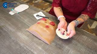 How to Cut and Fit an Ostomy Wafer for a Stoma [upl. by Ford]