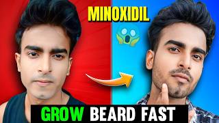 Minoxidil For Beard Growth FasterDay 1100  How To Grow Beard Faster Using Minoxidil [upl. by Laura]