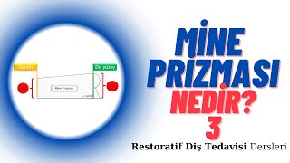 Mine prizması nedir 3 Restoratif Diş Tedavisi Dersleri [upl. by Paradies]