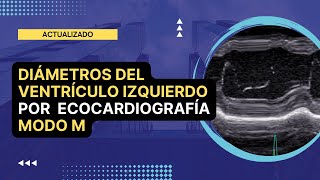 ✅DIAMETROS DEL VENTRICULO IZQUIERDO por Ecocardiografía MODO M 💡Actualizado [upl. by Angrist]