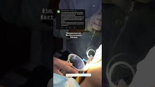 Best treatment for TMJ pain  arthrocentesis tmjprp drinqalabfareed tmjpain [upl. by Ellezig926]