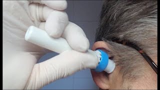 Test Elektrischer Ohrenreiniger Ohrenschmalz Entferner testen EarWax Remover Vaccuum Wattestäbchen [upl. by Bethany303]