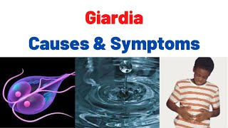 Giardiasis Fatty Stool SymptomsCauses Treatment Summary What is Giardia Giardia lamblia [upl. by Ultann]